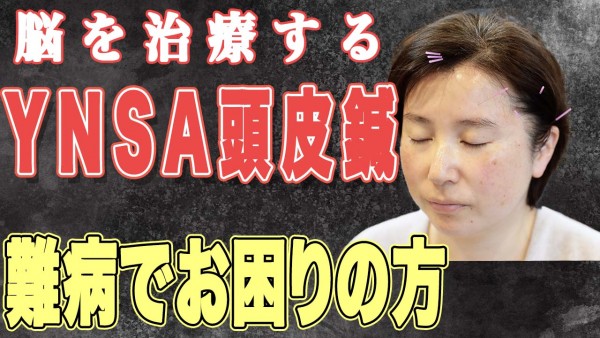 YNSA頭皮鍼　難病でお困りの方サムネイル