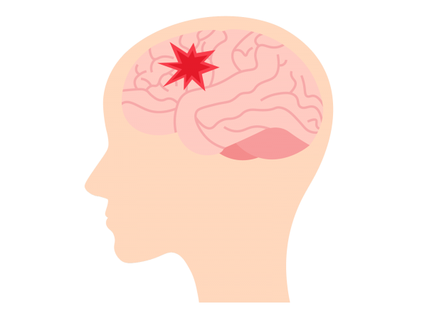 自律神経の調和を取り戻す：YNSAが導く頭痛・不眠・めまいの克服サムネイル